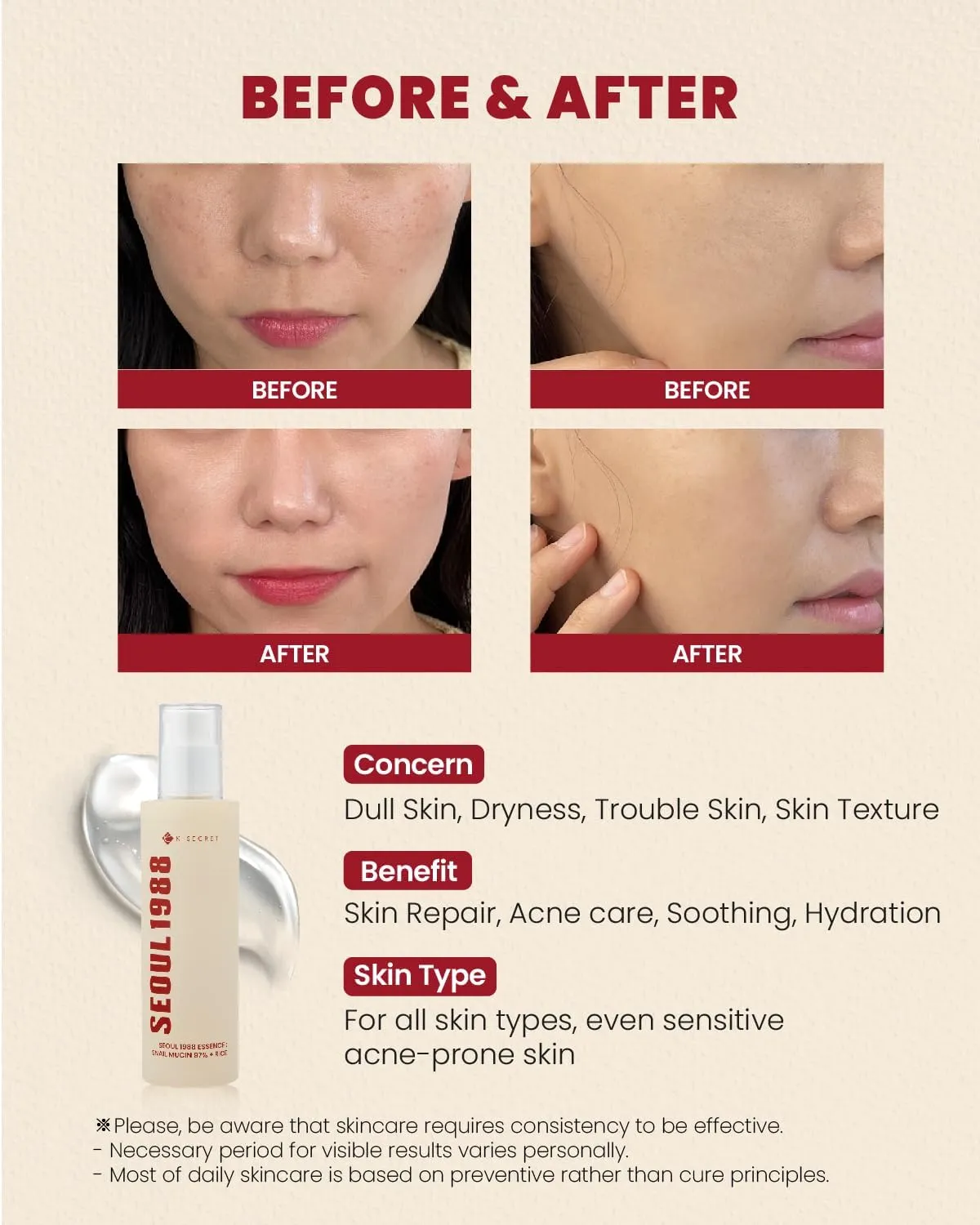 K-Secret Seoul 1988 Essence : Snail Mucin 97% + Rice